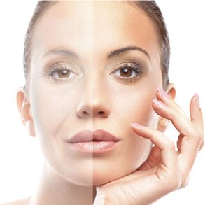 Rejuvenecimiento de la piel facial